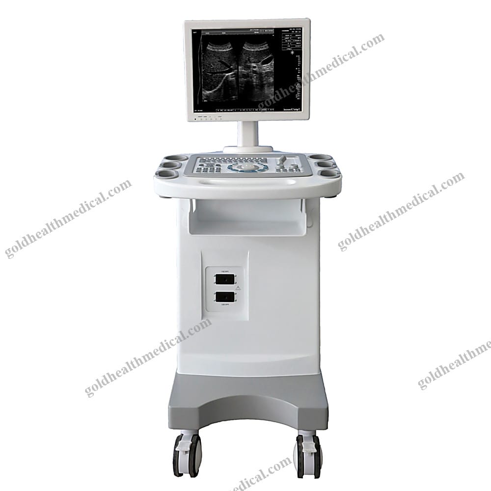 Full Digital Ultrasound Diagnostic SystemPortable 15 LED 0