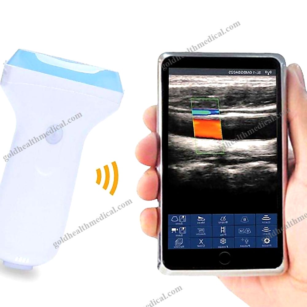 A75 Wireless Color Doppler Ultrasound Scanner with Linear Probe for