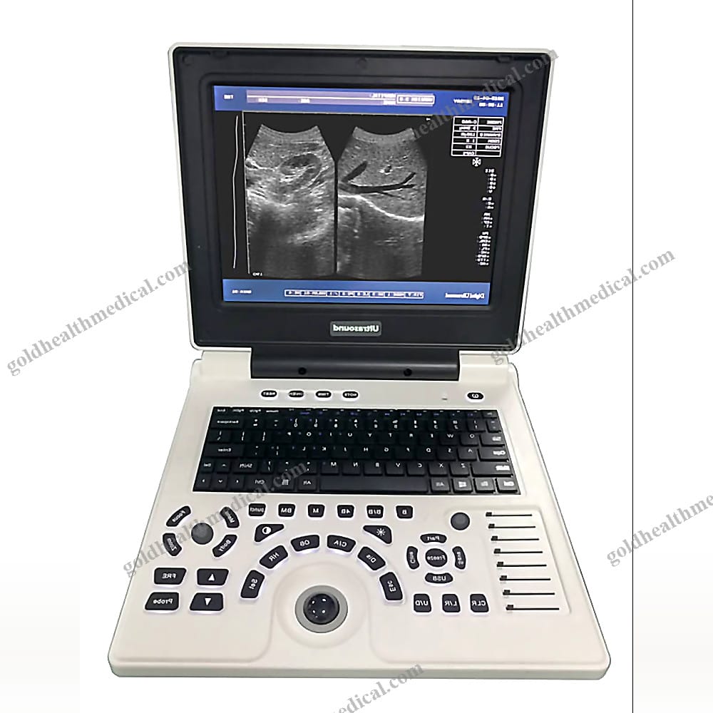 Portable Veterinary Ultrasound Scanner