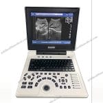 Portable Veterinary Ultrasound Scanner