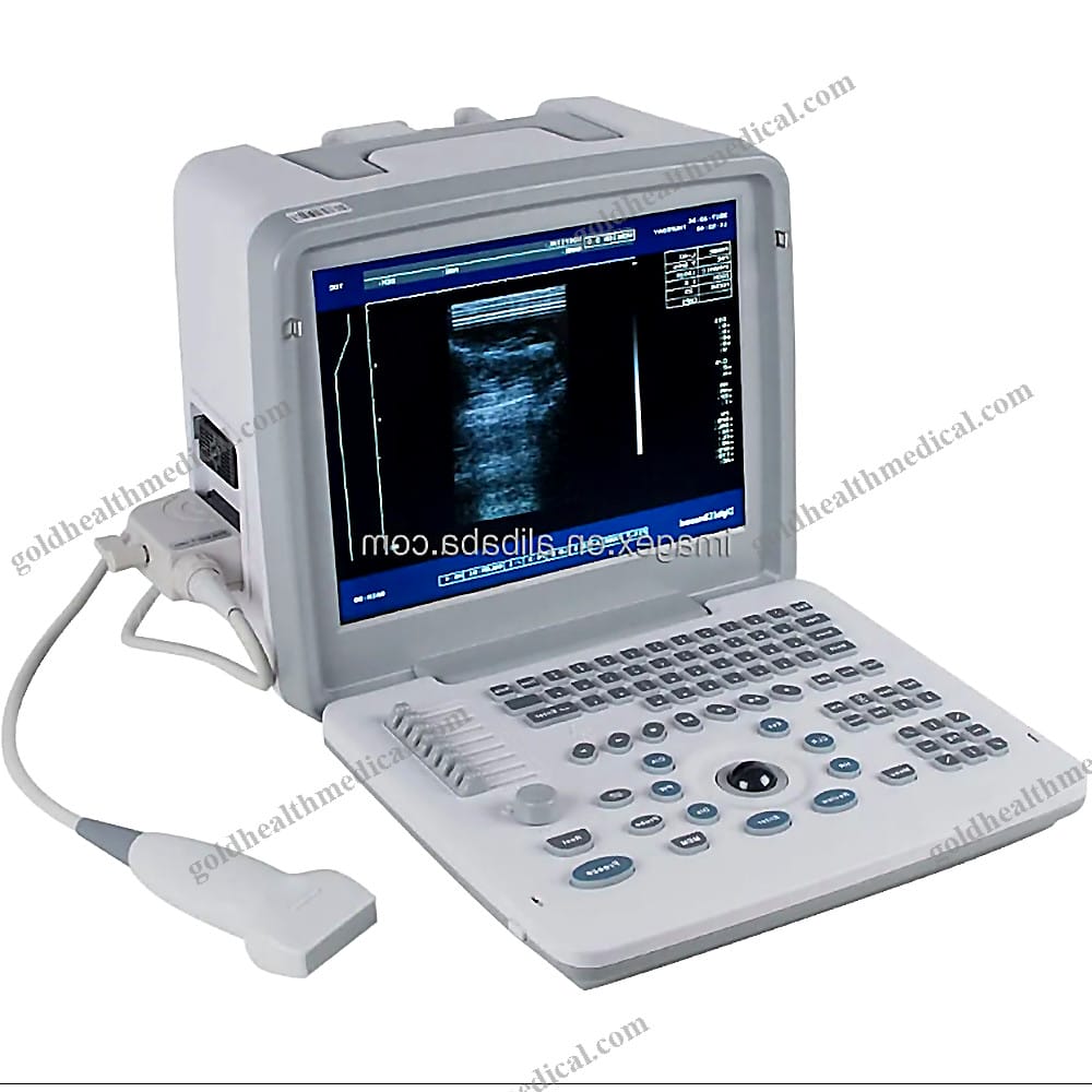 Portable Ultrasound for Abdomen and OBGYN Use
