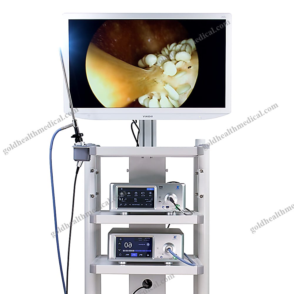 Ultra HD Digital Colposcope Set for Gynecology