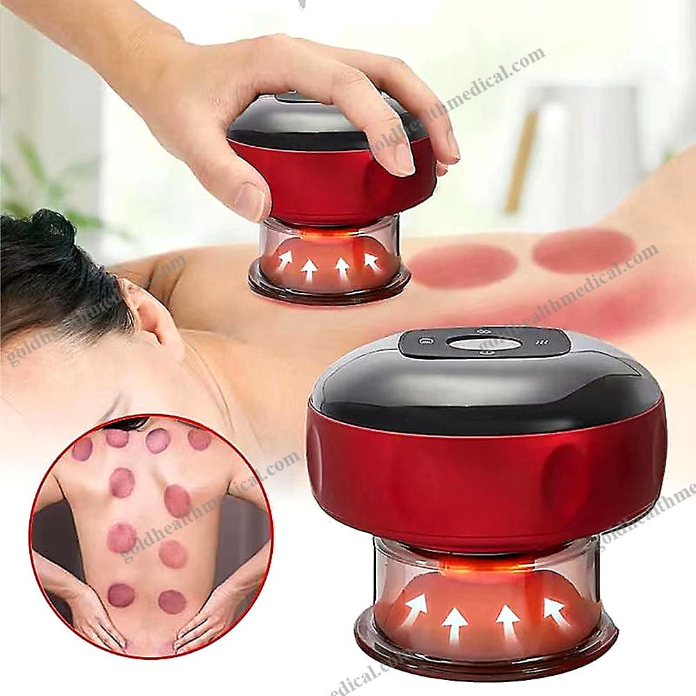Smart Cupping Therapy Massager Device 2025
