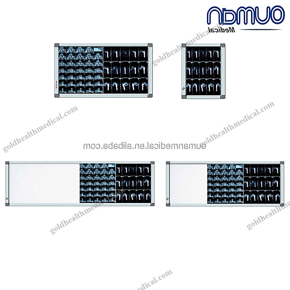 Medical Xray Film Viewer Led Negatoscope Radiography Viewer Factory Price