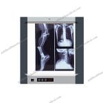 MG01 Micare Medical Xray Film Viewer LED Hospital Diagnosis Machine with