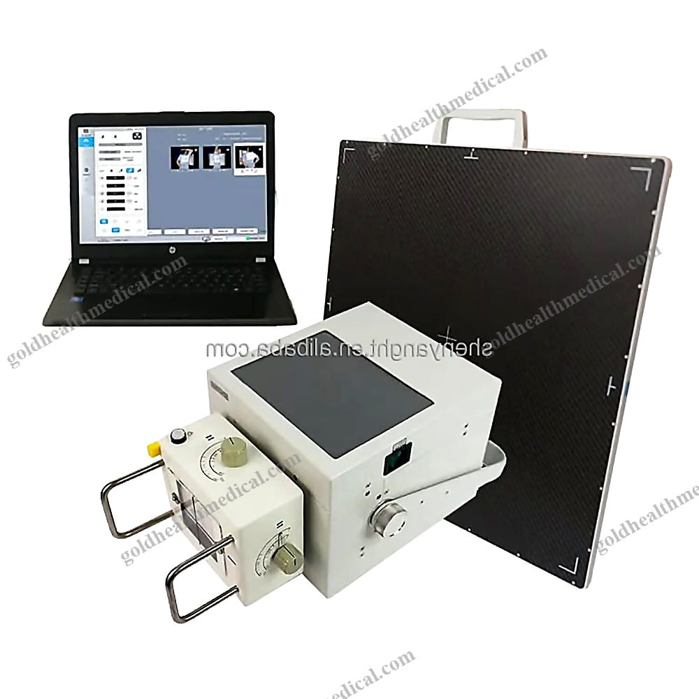Portable Digital XRay Machine 53kW High Frequency Veterinary Dr