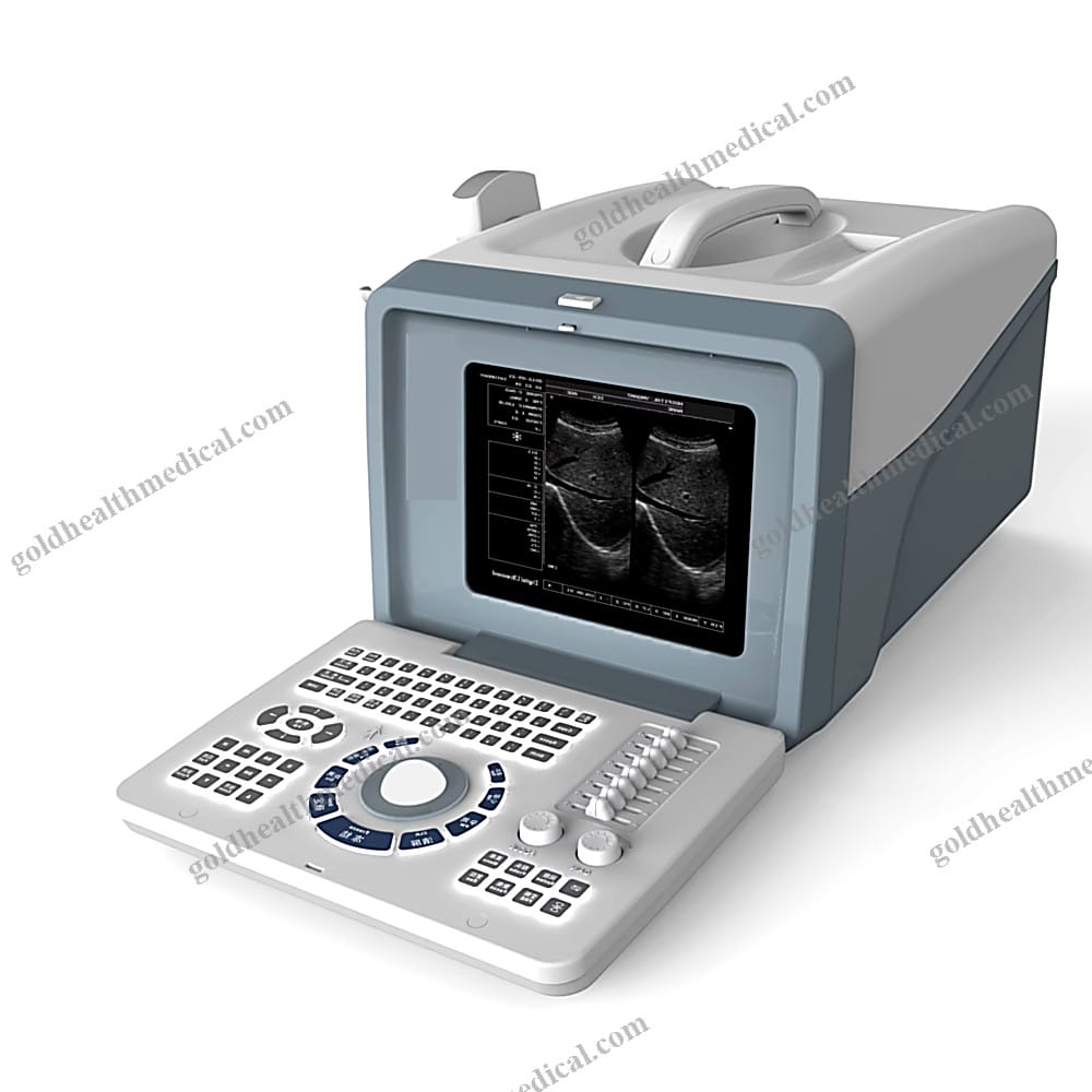 S218 Portable MedicalGrade Ultrasound Machine with Large Color Display