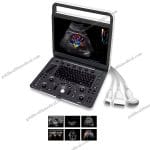 Sonoscape E1E2E2v Portable Ultrasound Scanner with