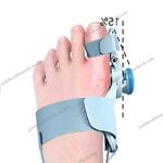 2025 BestSelling Adjustable Bunion Corrector for Medical Rehabilitation