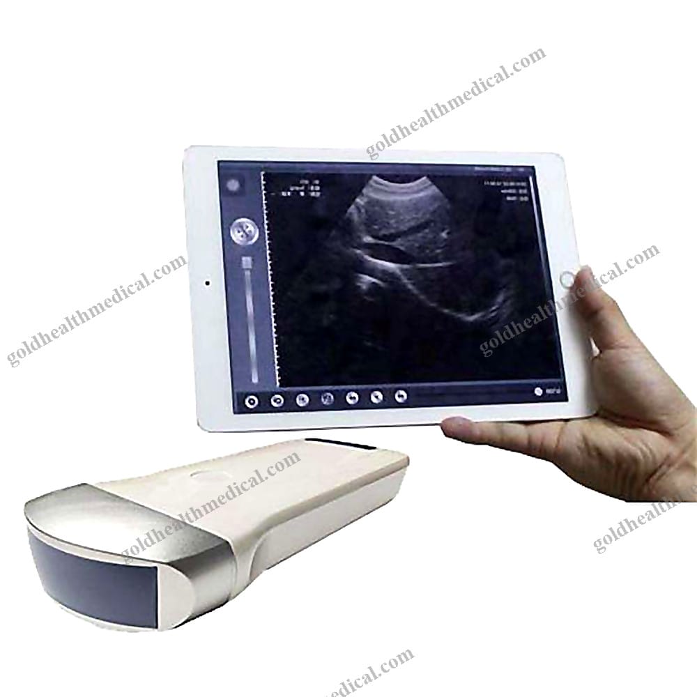 60197150011_1 Compact Ultrasound Scanner for Veterinary Use - Image 1