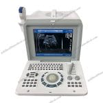 HBW2 Portable Medical Ultrasound Scanner BW Mode