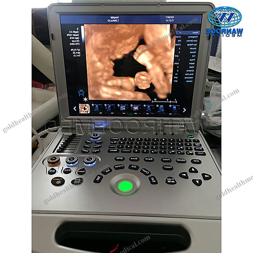 USC60PLUS Portable Color Doppler Ultrasound Machine for Pregnancy and