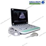 Portable Color Doppler Ultrasound Echo Machine
