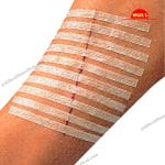 SteriStrip Pro Disposable Sterile Wound Closure Solution