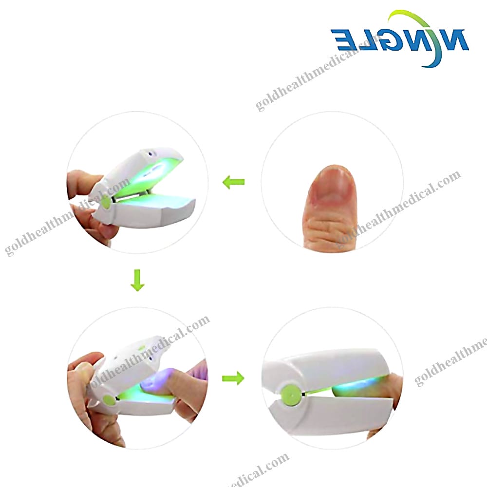 Onychomycosis Laser Treatment Device for Nail Fungus Removal