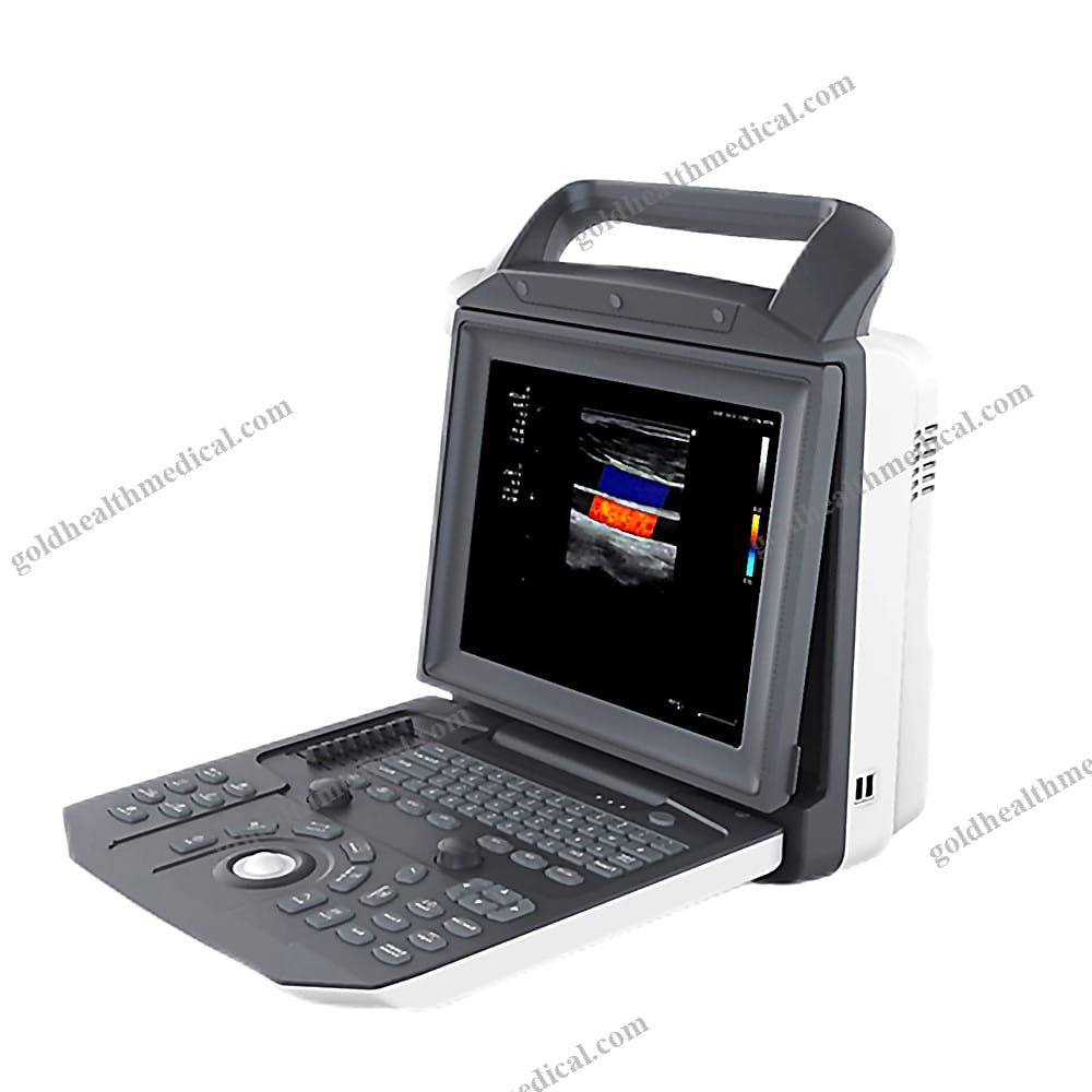 Medico Portable Color Doppler CW TDI Cardiac Ultrasound Machine Price