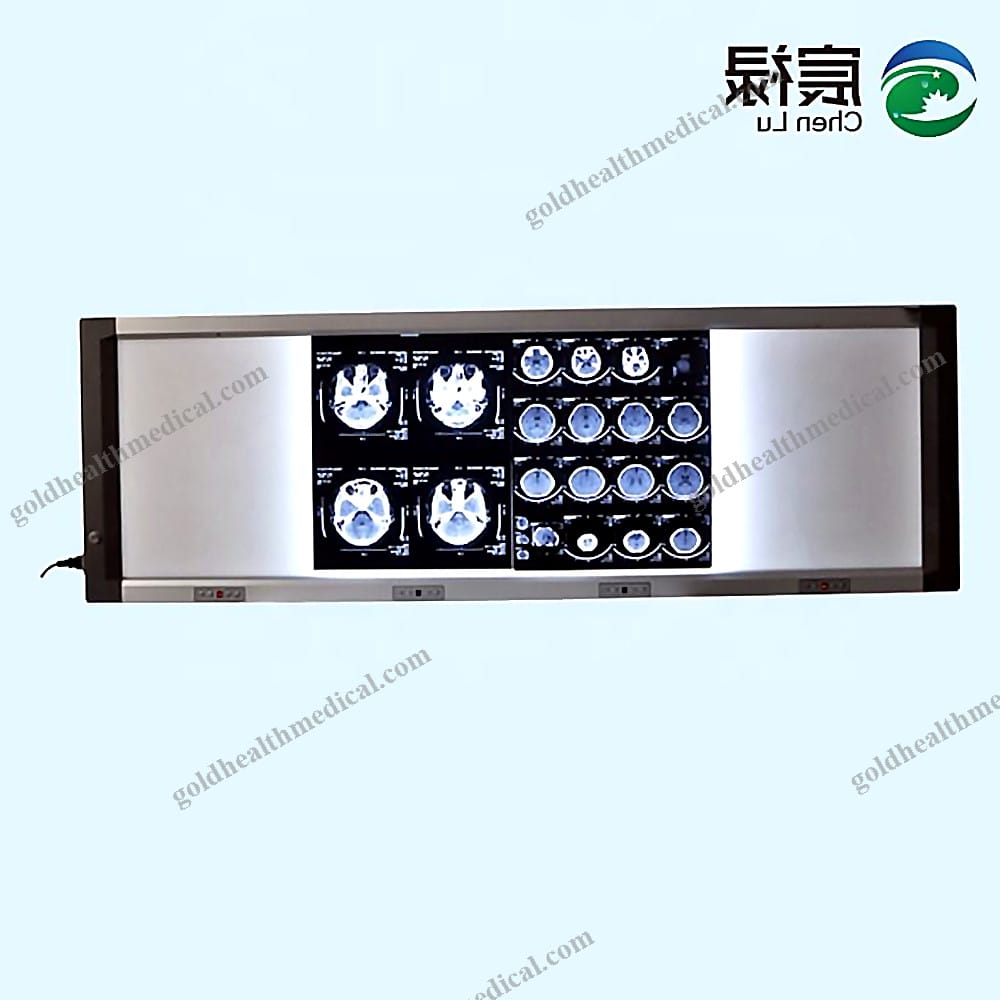 Adjustable XRay Viewer Box for Radiography Films
