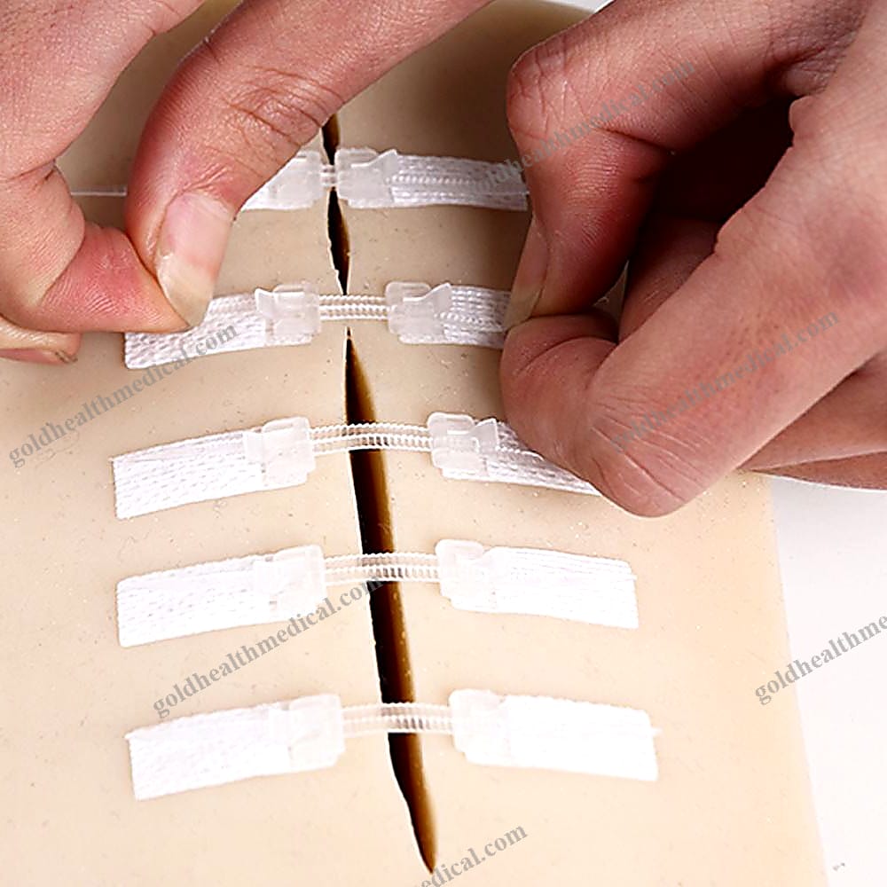 ZipStitch Wound Closure Device