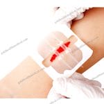 Zip Stitch Wound Closure Device